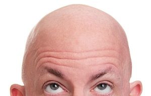 Is hair transplant for you?